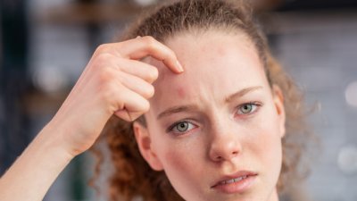 Сърбеж по челото – какви могат да са причините