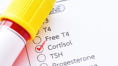 Как да намалите кортизола в тялото 