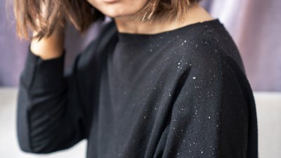 Край на белия прах по раменете! Маска с банан спира пърхота