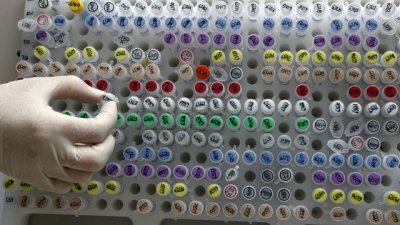 НЗОК ще плаща скенер и инвитро процедурите през 2013