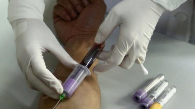 Кръвен тест ще показва дали ракът се връща отново