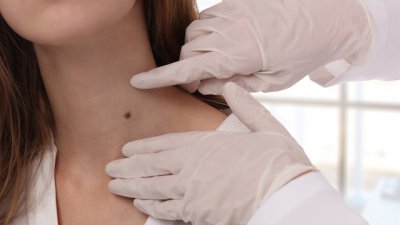 Безплатни прегледи при дерматолозите на ВМА