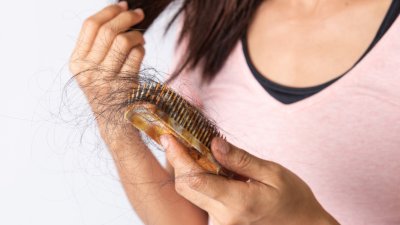 Косопад при жените: 4 причини, които да имате предвид