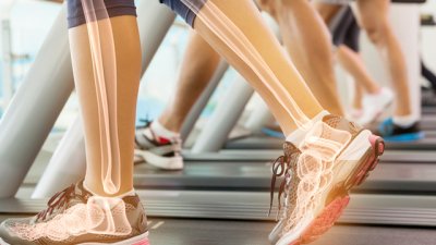 Как да се погрижим за здравето на костите