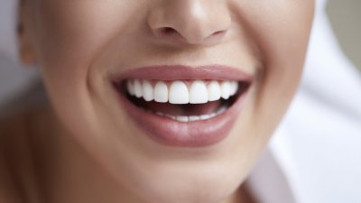 3 хитри домашни начина да премахнете петната по зъбите