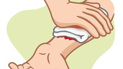 Как да спрете кървенето на рани?