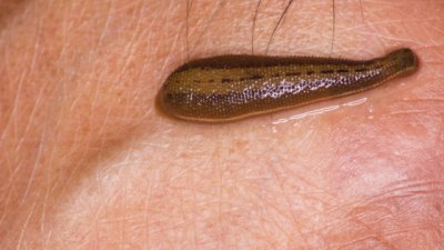 Абсурдни методи на лечение от миналото