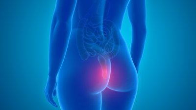 Полезни храни при хемороиди