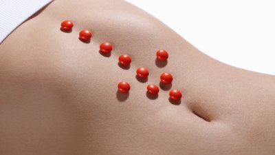 Нередовният цикъл крие риск от рак на яйчниците