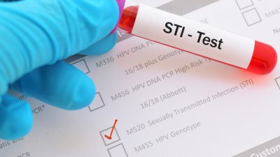 Полово предавани болести, които нямат симптоми 