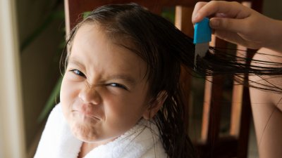 Има ли детето ми въшки?