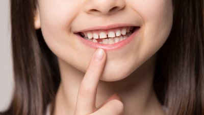 Стоматолог: Децата трябва да ходят на преглед 3-4 пъти на година