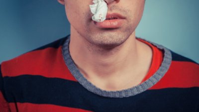 Домашни лекове за спиране на кръвотечението от носа