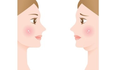 Как да премахнете двойната брадичка