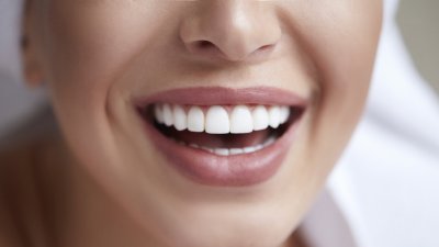 Хитри трикове за почистване на плака по зъбите