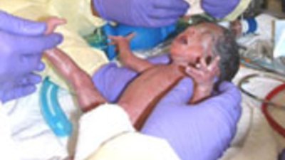 Детската смъртност