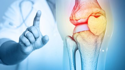 Д-р Узунов: Работата на компютър е основен фактор за ставни заболявания