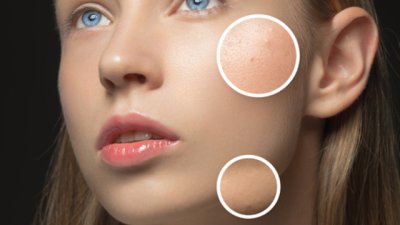 Ако имате мазна кожа, запомнете тези неща!