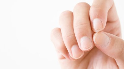 Ноктите ви се разслояват и чупят – какво означава? 