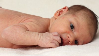 Често срещани кожни проблеми при бебета