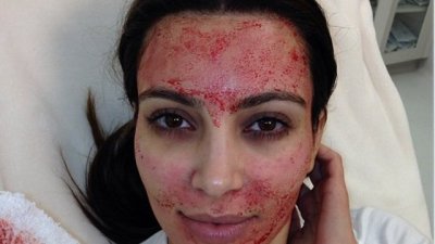 Ким Кардашиян се подмладява с кървав лифтинг