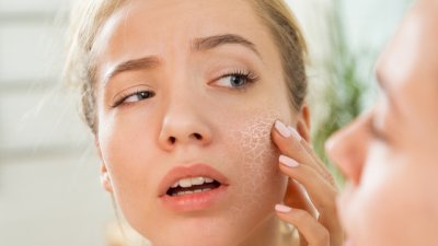 Какво причинява сухата кожа