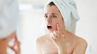 Появата на акне може да подсказва за здравословни проблеми и не само
