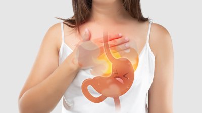 10 необичайни симптома на киселинен рефлукс 