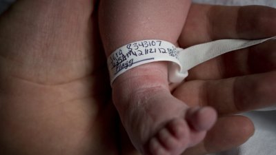 Куриоз в гинекологията – жена роди две двойки еднояйчни близнаци