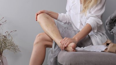 Подпухване и отичане на краката – 5 начина да намалим дискомфорта