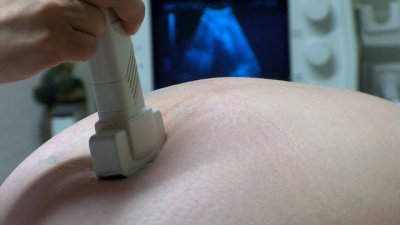 Кога бременната жена трябва да звъни спешно на гинеколога?