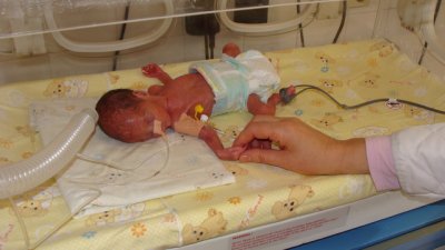 Спасиха 3 недоносени бебета по 800 грама в Бургас