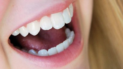 Сухота в устата – симптом, на който трябва да обърнем внимание