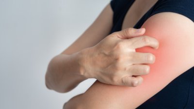 Храни, които потискат оплакванията при псориазис 