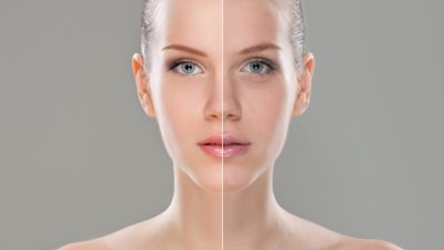 Как лицето може да подскаже за здравословен проблем?