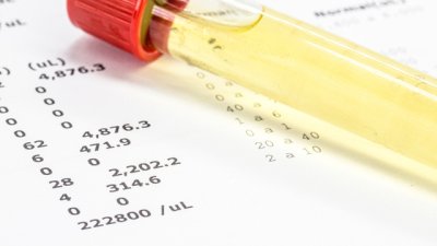 Какво предизвиква поява на пяна в урината