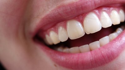 Най-вредните навици за зъбите