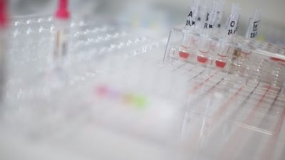 Откриха причината за честите спонтанни аборти