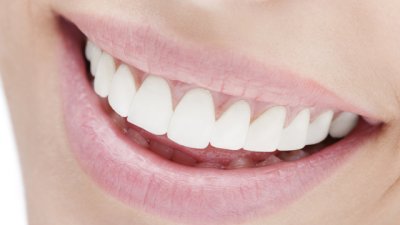 Натурални избелващи пасти за зъби