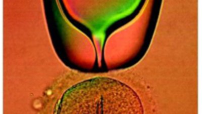 Новото в асистираните репродуктивни технологии