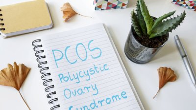 Хранене и двигателен режим при синдром на поликистозни яйчници