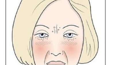 Имате ли „глутеново лице“