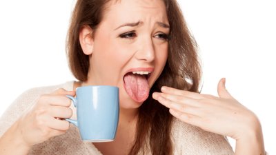 Домашни лекове при изгорен език 