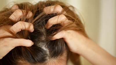 Най-голямата грешка, която правите с шампоаните против пърхот 