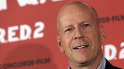 Какво помага при косопад?