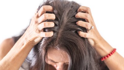 4 съставки, с които да сложите край на сърбежа по главата