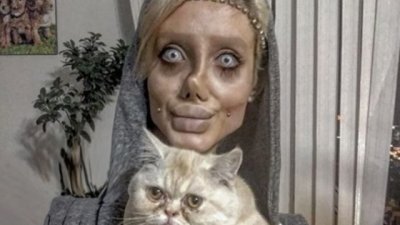 Да си направиш 50 операции, за да приличаш на Анджелина Джоли 