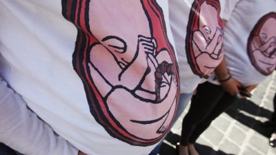 Бременността и първият бебешки албум