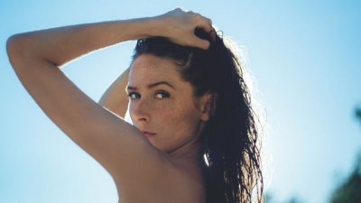 5 начина да третирате хиперпигментацията натурално