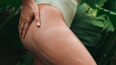 Изключително ефикасен домашен лосион против стрии с масла